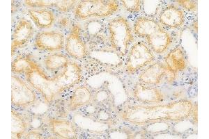 ABIN6262232 and ABIN6266695 at 1/100 staining human normal kidney tissue by IHC-P.