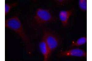 Immunofluorescence staining of methanol-fixed Hela cells using Zap-70(Phospho-Tyr319) Antibody. (ZAP7 (pTyr319) antibody)