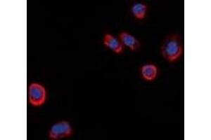 Immunofluorescent analysis of GPR101 staining in HeLa cells. (GPR101 antibody  (C-Term))