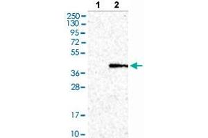 Western blot analysis of Lane 1: Negative control (vector only transfected HEK293T lysate), Lane 2: Over-expression lysate (Co-expressed with a C-terminal myc-DDK tag (~3. (CTSO antibody  (AA 71-176))