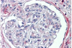 Human Kidney (formalin-fixed, paraffin-embedded) stained with PODXL antibody ABIN462244 followed by biotinylated goat anti-rabbit IgG secondary antibody ABIN481713, alkaline phosphatase-streptavidin and chromogen. (PODXL antibody  (AA 301-350))