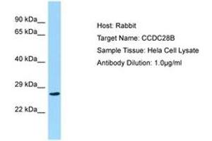 Image no. 1 for anti-Coiled-Coil Domain Containing 28B (CCDC28B) (C-Term) antibody (ABIN6750165)