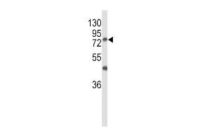 Western blot analysis of GALNT3 Antibody (Center) (ABIN653156 and ABIN2842724) in MCF-7 cell line lysates (35 μg/lane). (GALNT3 antibody  (AA 454-481))