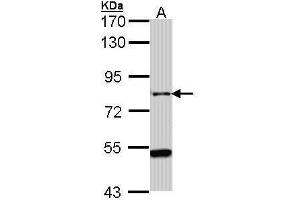 WB Image Sample (30 ug of whole cell lysate) A: Hep G2 , 7. (AGAP1 antibody  (C-Term))