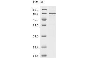 (Tris-Glycine gel) Discontinuous SDS-PAGE (reduced) with 5 % enrichment gel and 15 % separation gel.