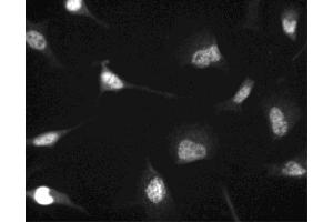 Immunofluorescent staining of HeLa (ATCC CCL-2) cells. (CDK4 antibody  (N-Term))
