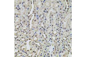 Immunohistochemistry (Paraffin-embedded Sections) (IHC (p)) image for anti-SWI/SNF Related, Matrix Associated, Actin Dependent Regulator of Chromatin, Subfamily C, Member 2 (SMARCC2) (AA 150-250) antibody (ABIN3022693)