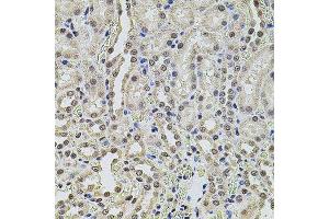 Immunohistochemistry of paraffin-embedded rat kidney using SMARCC2 antibody.