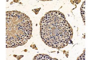 ABIN7096215 and ABIN7100277 at 1/100 staining mouse testis tissue by IHC-P. (PTCD1 antibody)