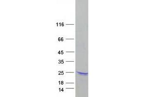 Validation with Western Blot (ARPC5 Protein (Myc-DYKDDDDK Tag))