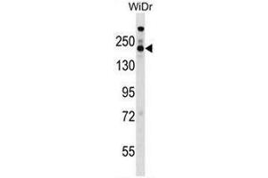 STAG1 Antibody (Center) western blot analysis in WiDr cell line lysates (35µg/lane). (Stromal Antigen 1 antibody  (Middle Region))