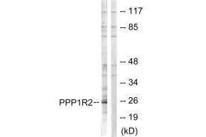 Western blot analysis of extracts from Jurkat cells, using PPP1R2 (Ab-120/121) antibody. (PPP1R2 antibody  (Ser120, Ser121))