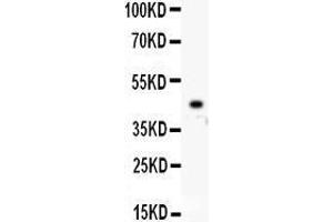Observed bind size: 45KD (Tumor Protein p73 antibody  (AA 1-198))