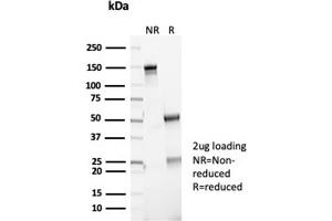 SDS-PAGE Analysis Purified P16INK4a Recombinant Rabbit Monoclonal (CDKN2A/7081R). (Recombinant CDKN2A antibody)