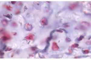 Anti-PTHR / PTHR1 antibody IHC staining of human bone, fractured callus. (PTH1R antibody  (Internal Region))