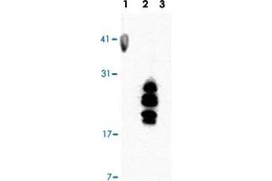 Western blotting with HBEGF monoclonal antibody, clone 4G10 .