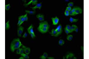 Immunofluorescence staining of MCF-7 cells with ABIN7155241 at 1:133, counter-stained with DAPI. (HRH4 antibody  (AA 204-292))