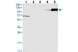 Western blot analysis of Lane 1: RT-4, Lane 2: U-251 MG, Lane 3: Human Plasma, Lane 4: Liver, Lane 5: Tonsil with ANKRD44 polyclonal antibody . (ANKRD44 antibody)