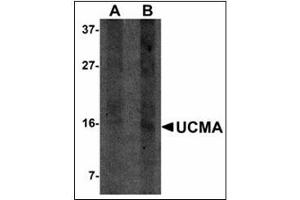 Western blot analysis of UCMA in SW1353 cell lysate with UCMA antibody at (A) 2. (UCMA antibody  (C-Term))