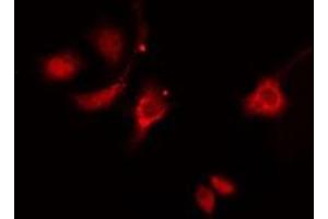 ABIN6276317 staining  HeLa cells by IF/ICC. (HSP27 antibody  (N-Term))