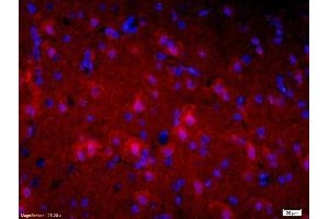 Formalin-fixed and paraffin-embedded rat brain labeled with Mouse Anti-Alpha-Synuclein Polyclonal Antibody, Unconjugatedused at 1:200 dilution for 40 minutes at 37°C. (Alpha, beta Synuclein (AA 122-140) antibody)