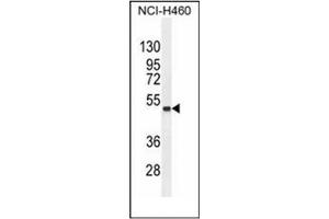 Western blot analysis of FNDC8 Antibody (Center) in NCI-H460 cell line lysates (35ug/lane). (FNDC8 antibody  (Middle Region))