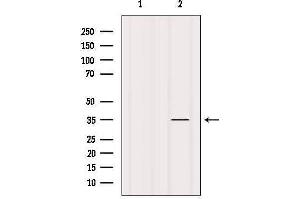 FN3K antibody  (Internal Region)