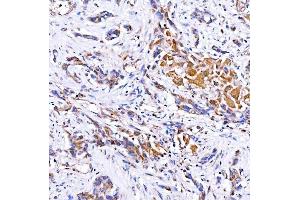 IHC analysis of Rab4/RAB4A using anti-Rab4/RAB4A antibody (ABIN7599733). (Rab4 antibody  (AA 110-216))
