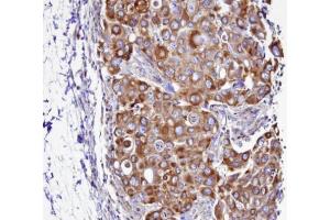 IHC-P Image Immunohistochemical analysis of paraffin-embedded H441 xenograft, using SEPT2 , antibody at 1:100 dilution. (Septin 2 antibody)