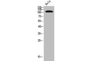 Western Blot analysis of Hela cells using Phospho-EphB1/2 (Y594/604) Polyclonal Antibody (EPH Receptor B1 antibody  (pTyr594, pTyr604))
