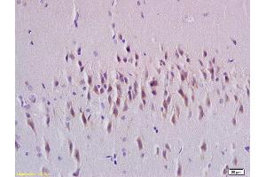 Formalin-fixed and paraffin embedded rat brain tissue labeled with Anti-Rab24 Polyclonal Antibody, Unconjugated (ABIN750373) at 1:200 followed by conjugation to the secondary antibody and DAB staining