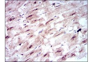Western Blotting (WB) image for anti-Solute Carrier Family 2 (Facilitated Glucose Transporter), Member 4 (SLC2A4) (AA 224-353) antibody (ABIN1846354)