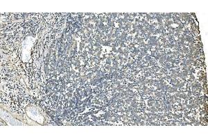 IHC analysis of IDH2 using anti-IDH2 antibody (ABIN7602787). (IDH2 antibody  (C-Term))