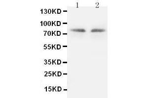 Anti-PKC gamma antibody, Western blotting Lane 1: Rat Brain Tissue Lysate Lane 2: Rat Brain Tissue Lysate
