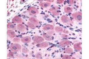 Immunohistochemistry (IHC) image for anti-Transient Receptor Potential Cation Channel, Subfamily A, Member 1 (TRPA1) (Internal Region) antibody (ABIN2469515)