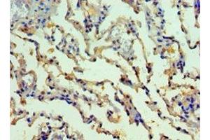 Immunohistochemistry of paraffin-embedded human lung tissue using ABIN7155522 at dilution of 1:100 (SMYD1 antibody  (AA 1-350))