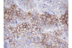 Image no. 1 for anti-Melanoma Antigen Family B, 18 (MAGEB18) antibody (ABIN1499274)