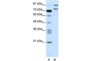 Human Jurkat; WB Suggested Anti-ZNF709 Antibody Titration: 2.