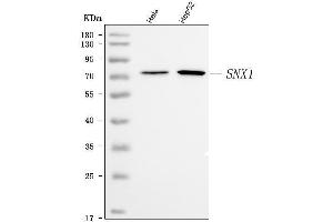 Western blot analysis of SNX1 using anti-SNX1 antibody (ABIN7602548).