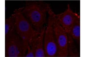 Image no. 1 for anti-Synuclein, alpha (SNCA) (pTyr133) antibody (ABIN401574) (SNCA antibody  (pTyr133))