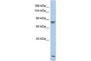 Western Blotting (WB) image for anti-phosphodiesterase 6A, CGMP-Specific, Rod, alpha (PDE6A) (N-Term) antibody (ABIN2786520) (PDE6A antibody  (N-Term))