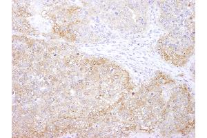 Immunohistochemistry (IHC) image for anti-Eukaryotic Elongation Factor-2 Kinase (EEF2K) (AA 675-725) antibody (ABIN7448957) (EEF2K antibody  (AA 675-725))