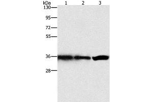 Western Blot analysis of Hela, 293T and 231 cell using GNB1 Polyclonal Antibody at dilution of 1:450 (GNB1 antibody)