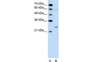 Western Blotting (WB) image for anti-Guanidinoacetate N-Methyltransferase (GAMT) antibody (ABIN2462453) (GAMT antibody)