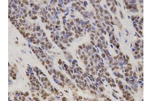 Immunohistochemistry (IHC) image for anti-Hepatoma-Derived Growth Factor (HDGF) antibody (ABIN1876535) (HDGF antibody)