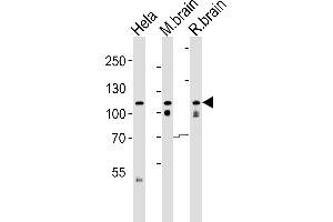 Western blot analysis of lysates from Hela cell line , mouse brain and rat brain tissue lysate(from left to right), using O(form S1) Antibody (C-term) (ABIN6242468 and ABIN6577502). (OPA1 (Form S1) (AA 895-929), (C-Term) antibody)