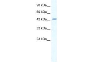 Western Blotting (WB) image for anti-DMRT-Like Family B with Proline-Rich C-terminal, 1 (DMRTB1) antibody (ABIN2461285) (DMRTB1 antibody)