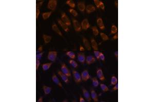 Immunofluorescence analysis of L929 cells using SEC61B antibody (ABIN7270173) at dilution of 1:100. (SEC61B antibody  (AA 1-96))