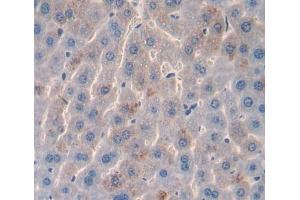 Used in DAB staining on fromalin fixed paraffin- embedded liver tissue (AADAT antibody  (AA 99-425))