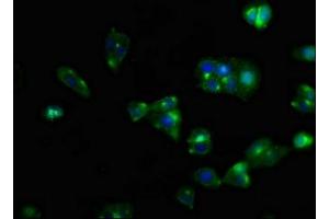 Immunofluorescent analysis of HepG2 cells using ABIN7146111 at dilution of 1:100 and Alexa Fluor 488-congugated AffiniPure Goat Anti-Rabbit IgG(H+L) (CXCR5 antibody  (AA 1-55))